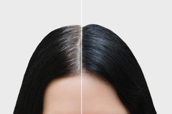 Shampoo Anticanas ReviTono™