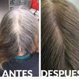 Shampoo Anticanas ReviTono™